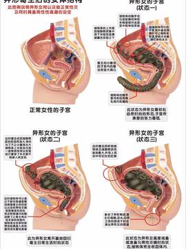 [红毛猪]异形女郎_100
